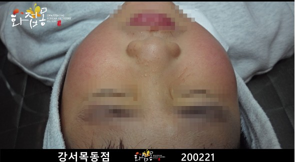 전후사진