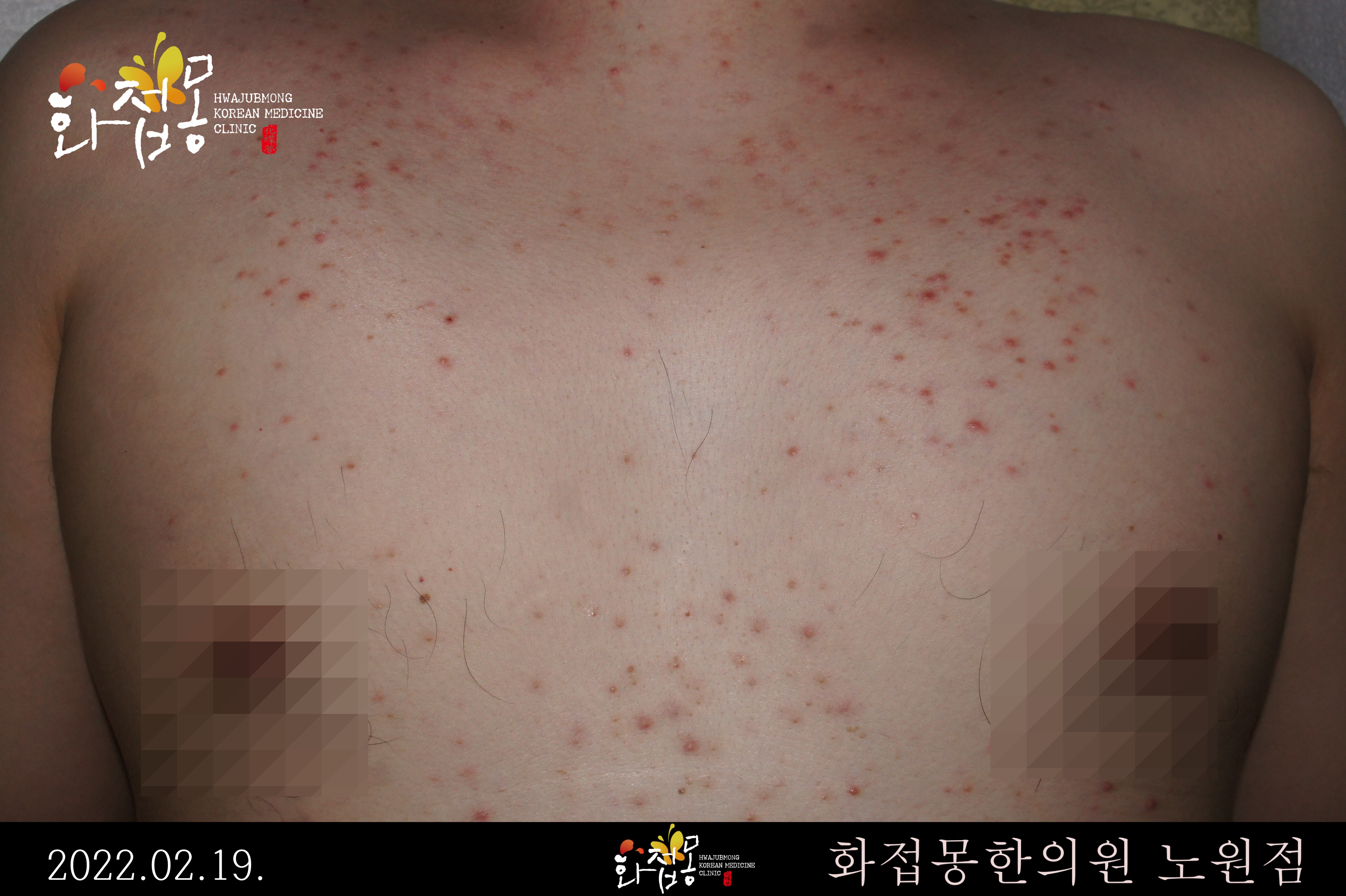 전후사진