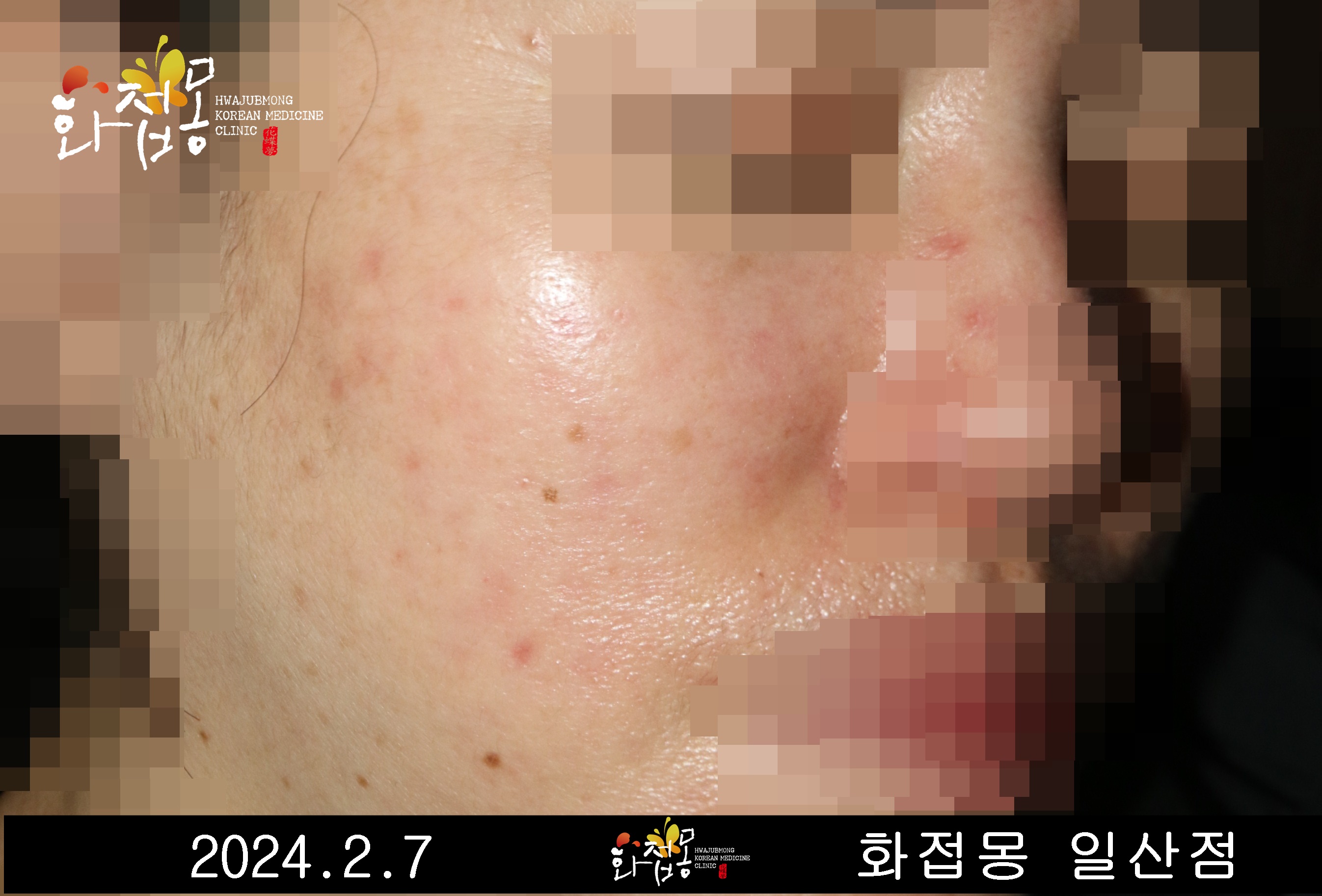 전후사진