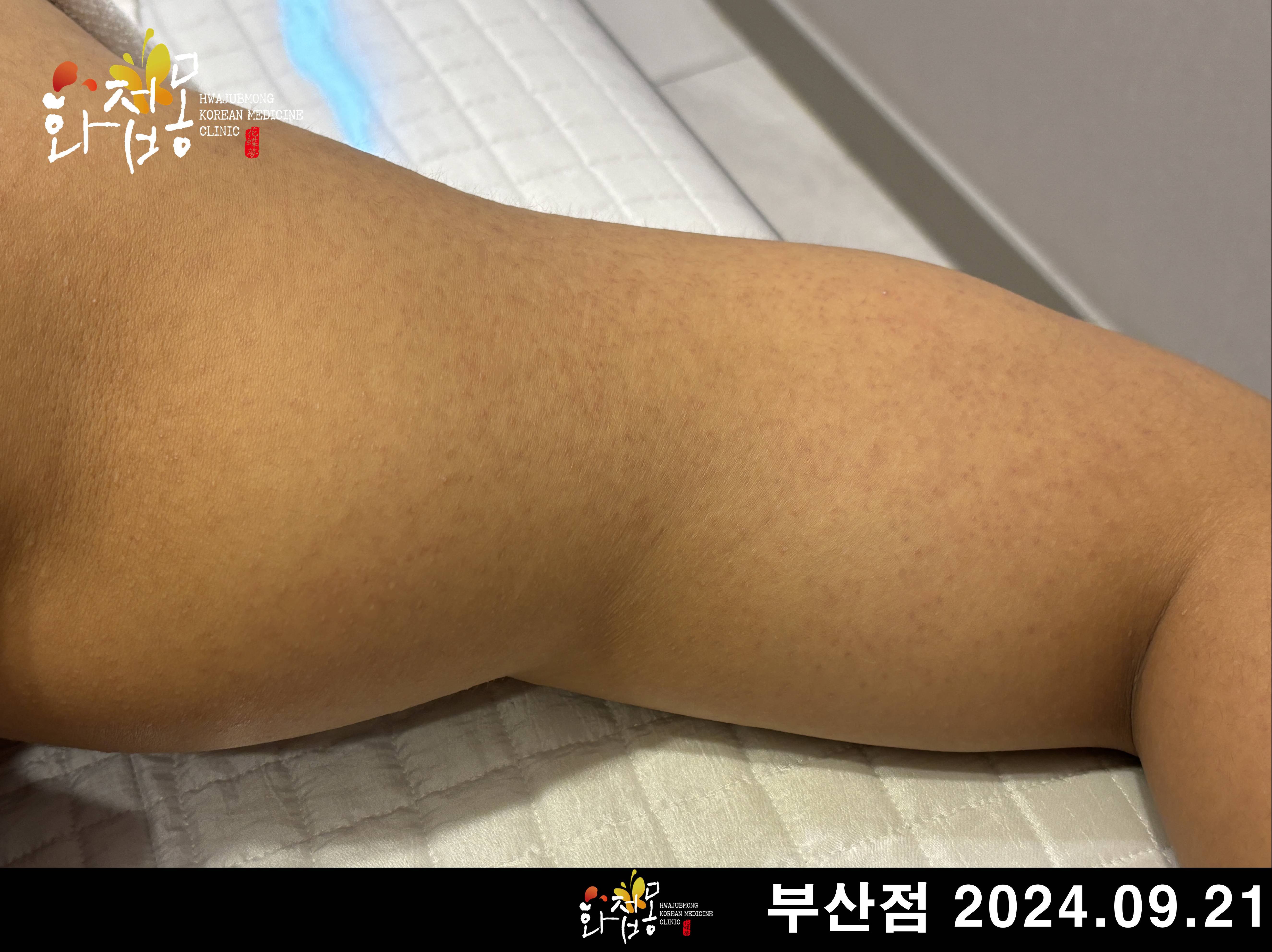 전후사진