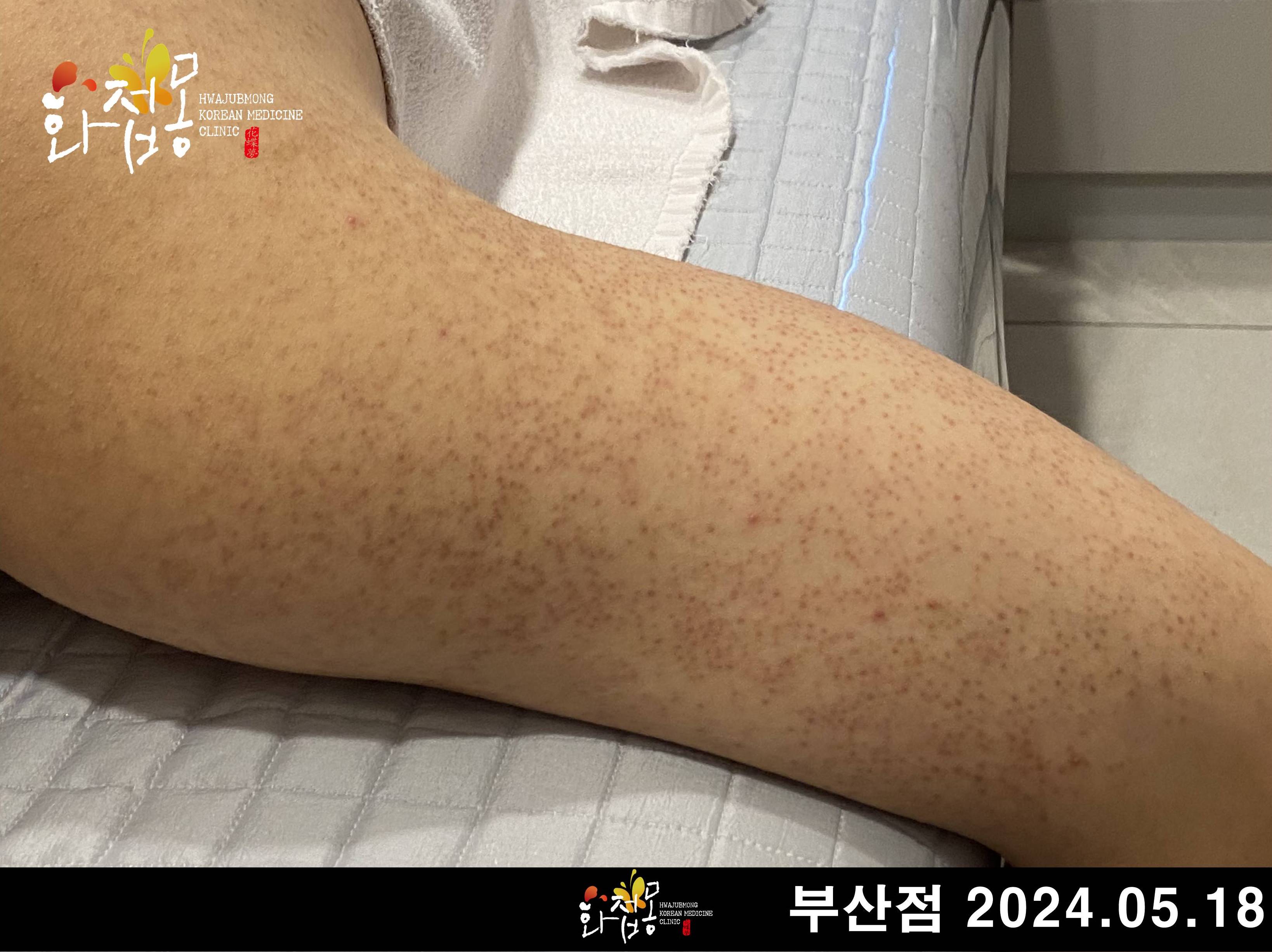 전후사진