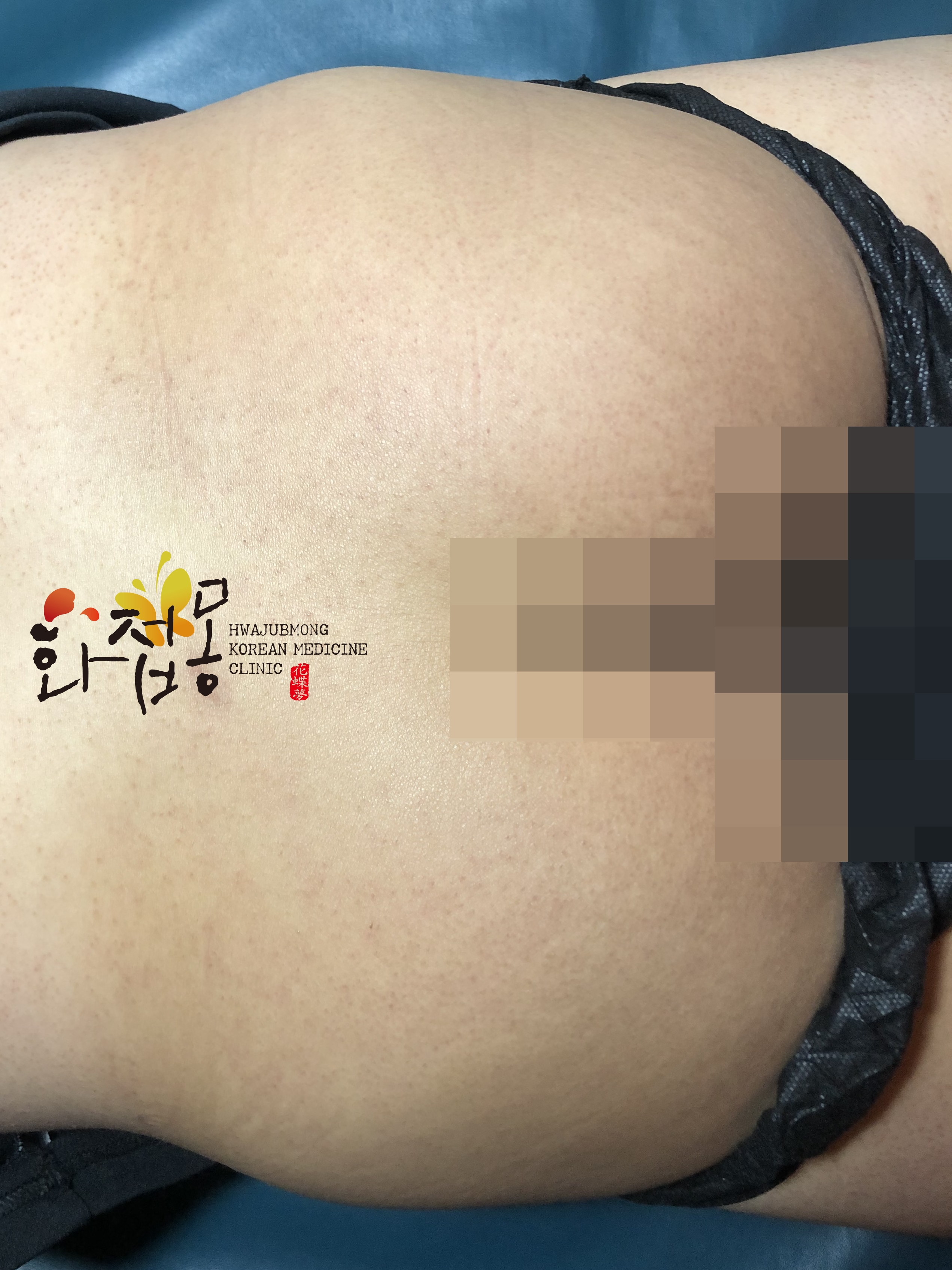 전후사진
