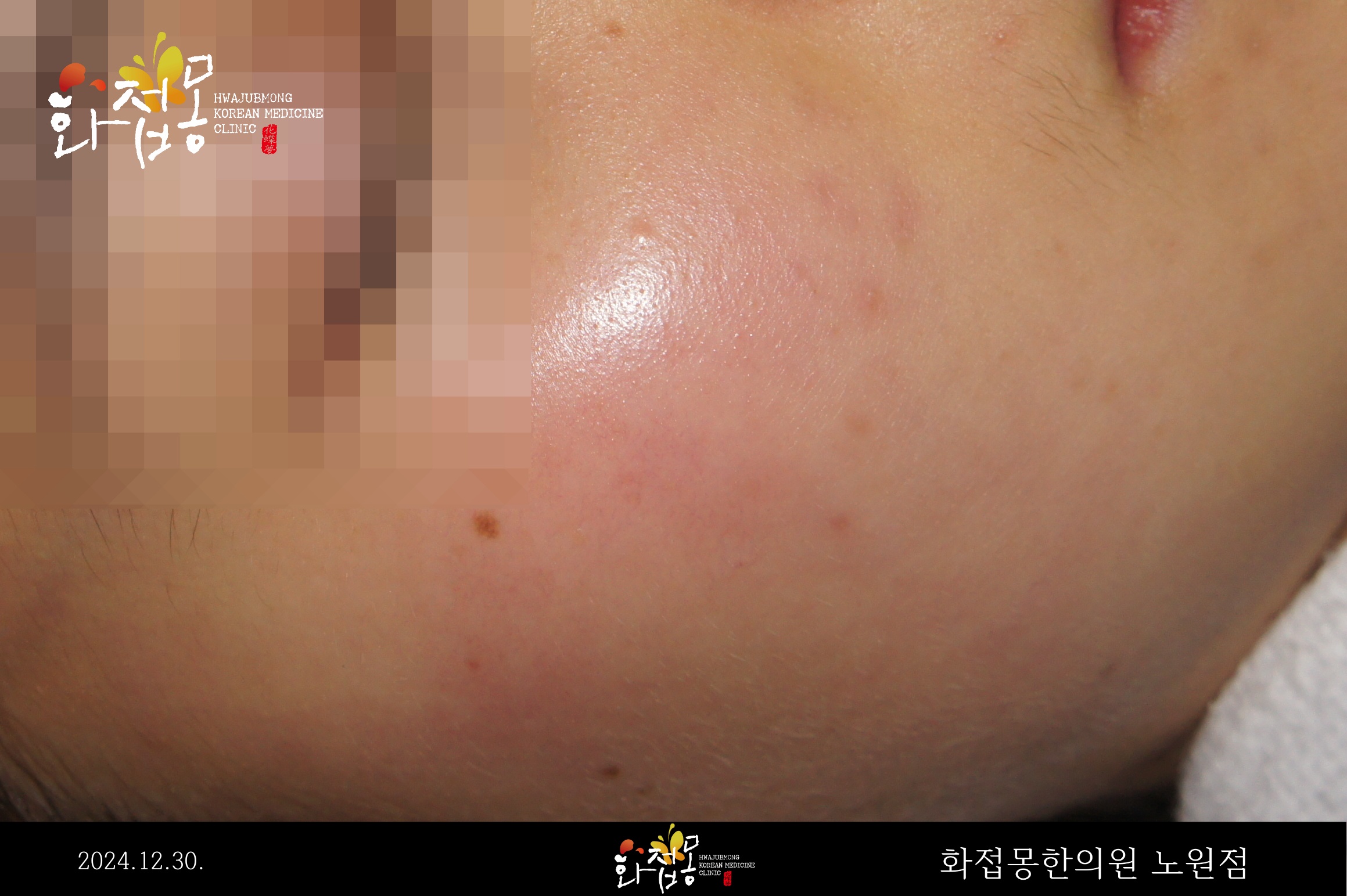 전후사진