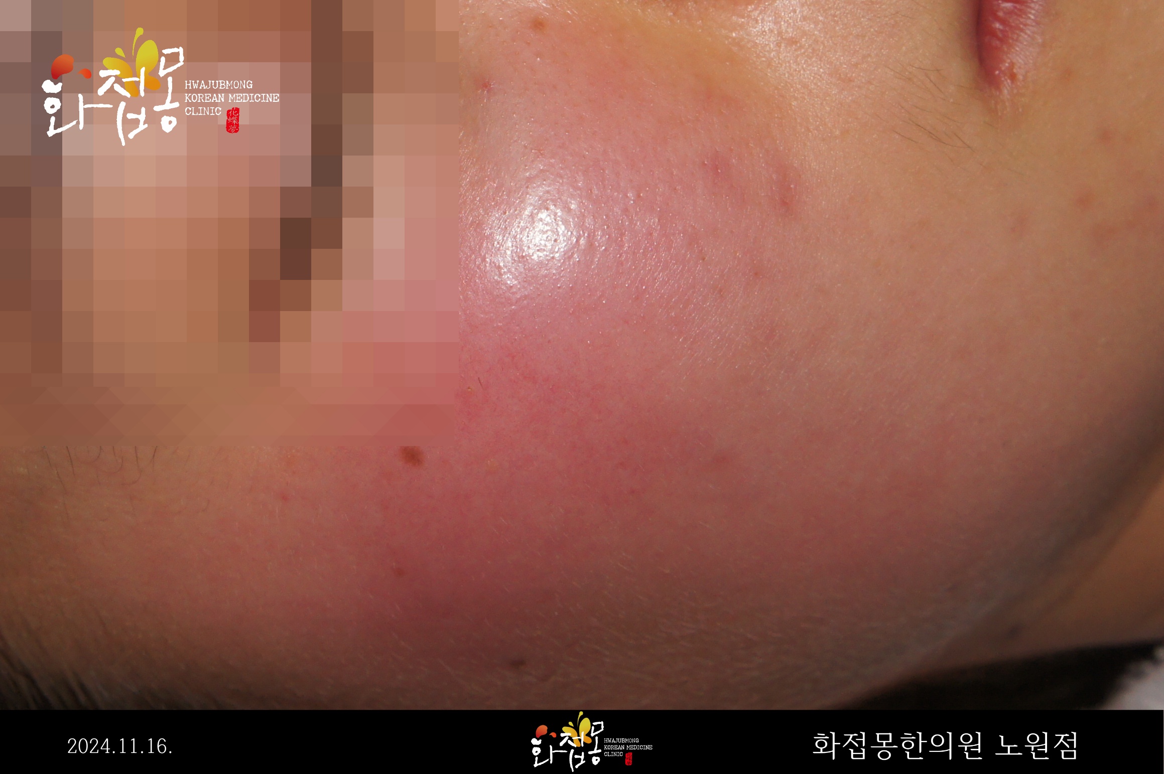 전후사진