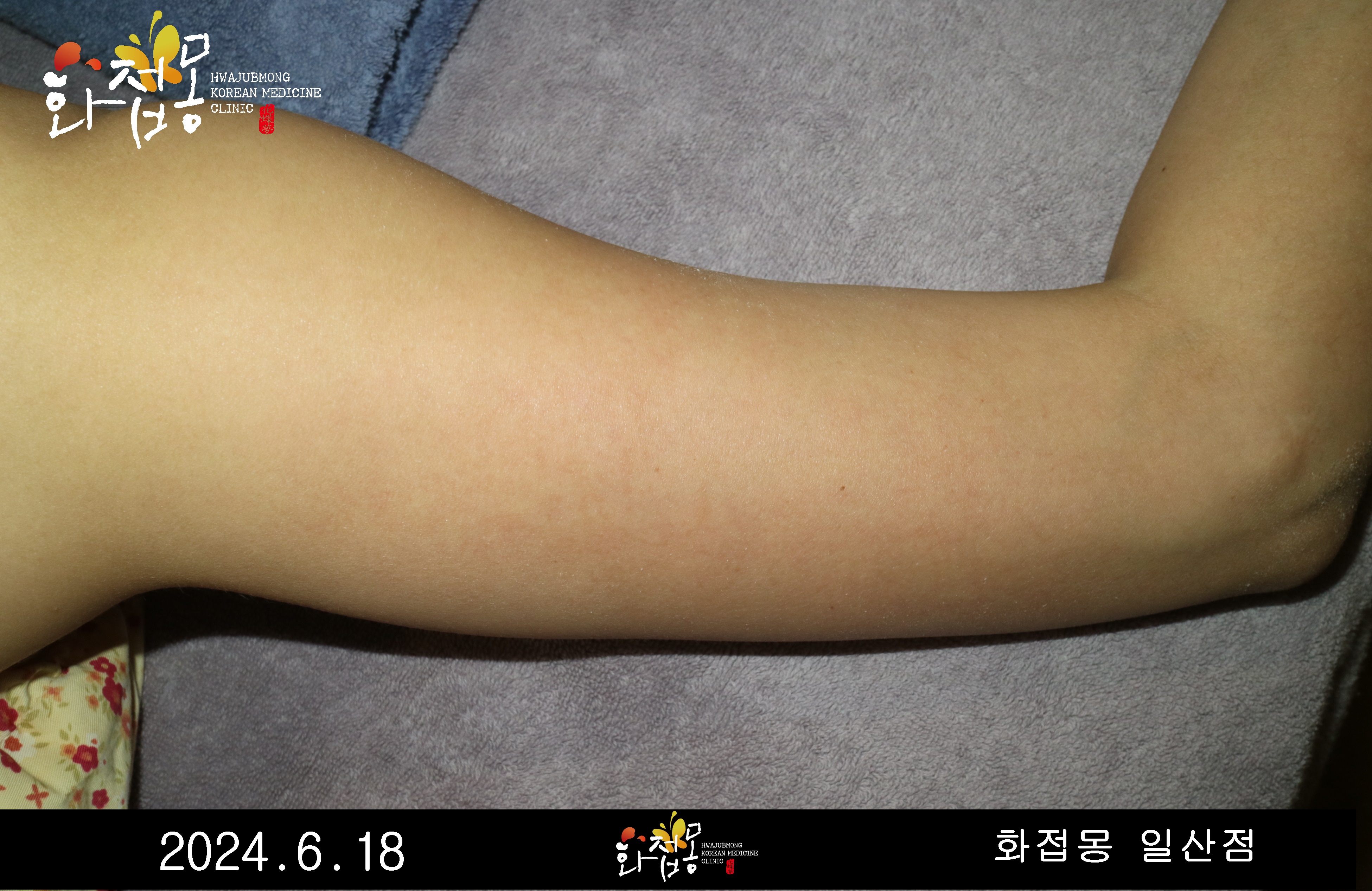 전후사진