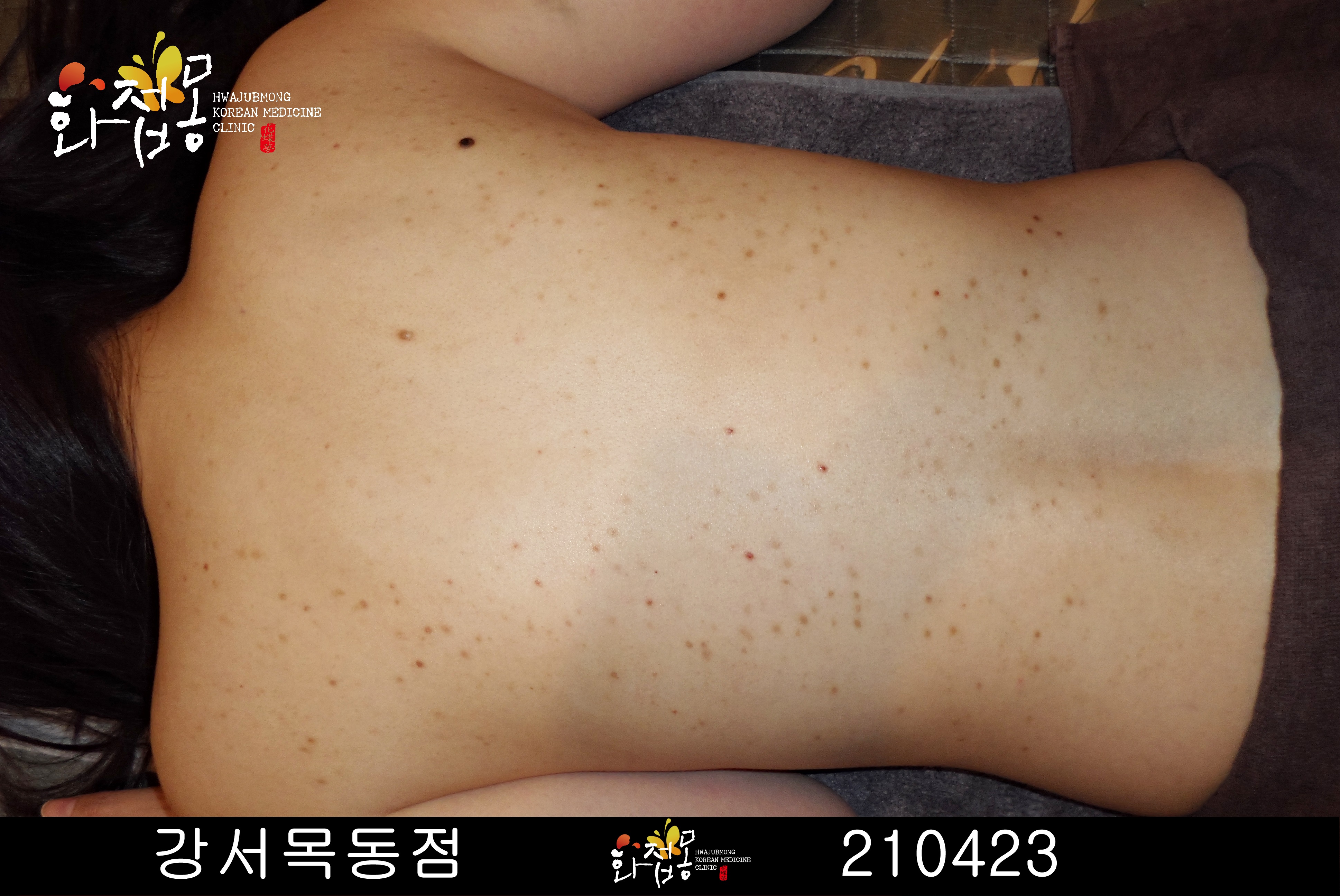 전후사진