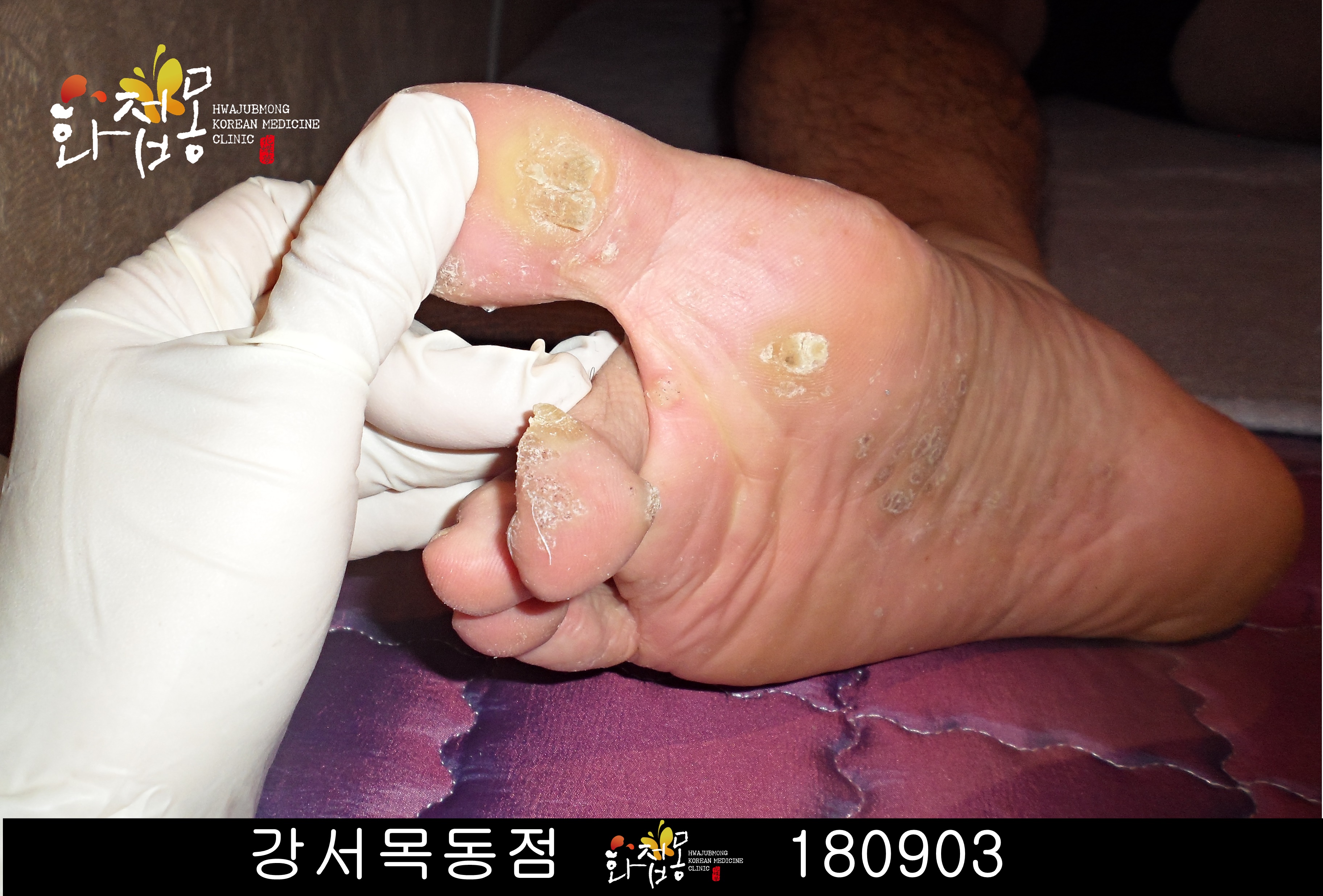 전후사진