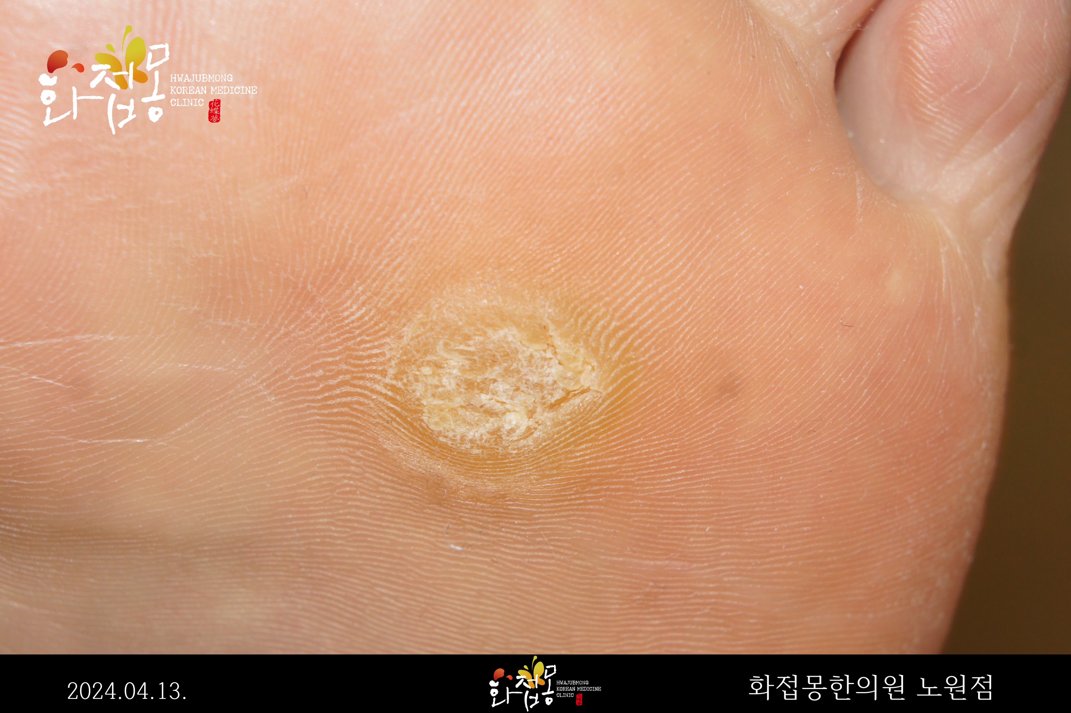 전후사진