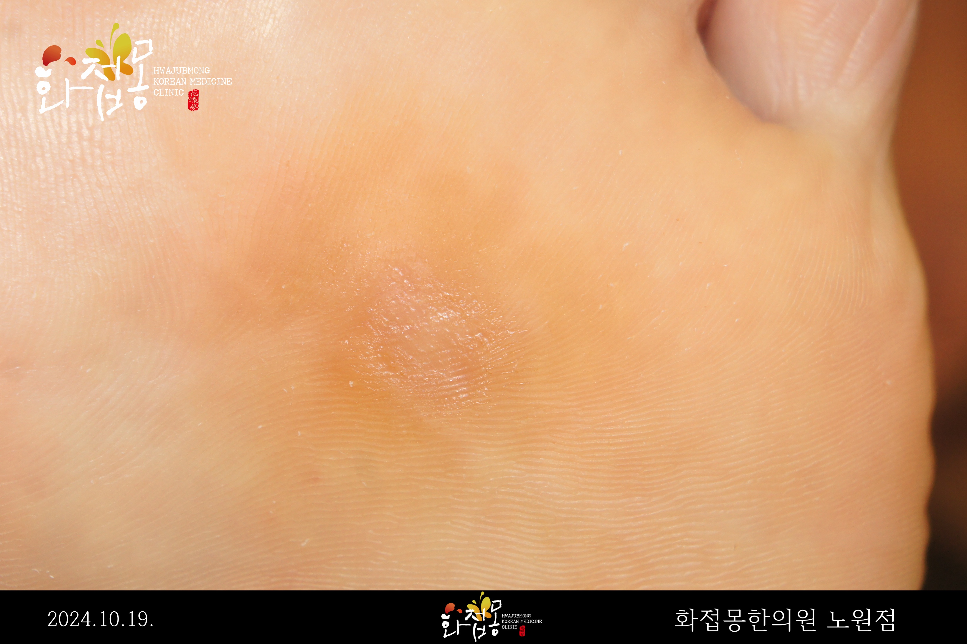전후사진