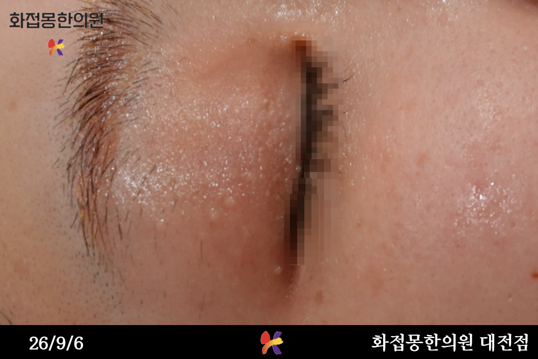 전후사진