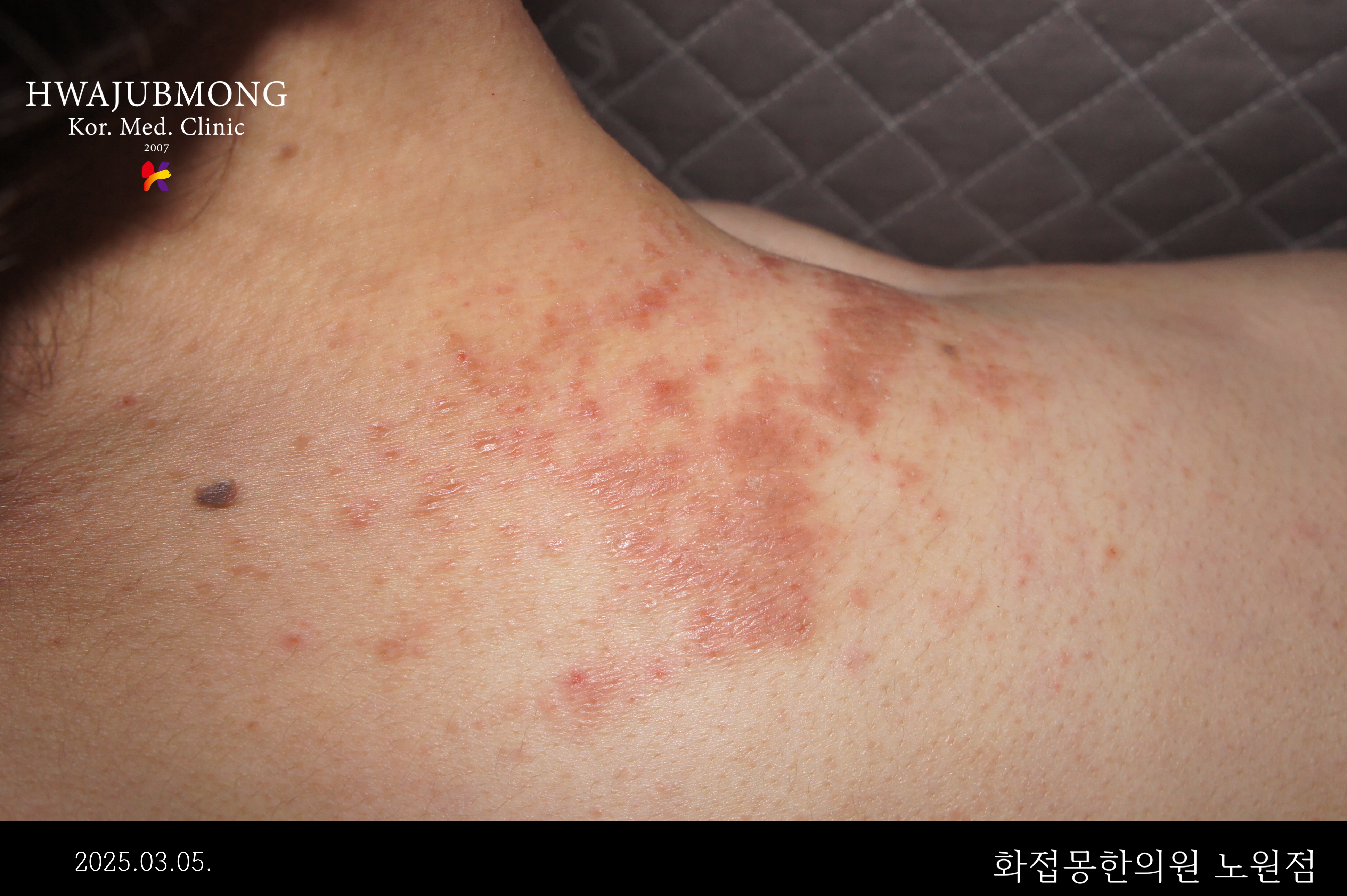 전후사진