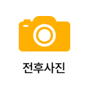전후사진