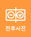 전후사진