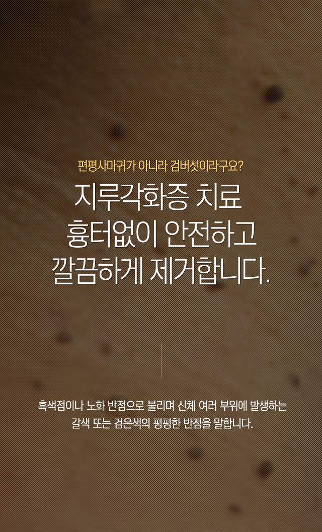 지루각화증(검버섯)